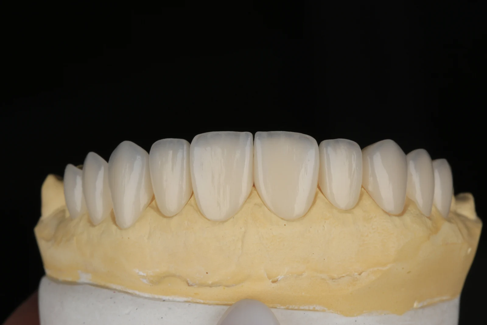 Detalhe de um modelo odontológico com peças dentárias, do acervo da Dra. Júlia